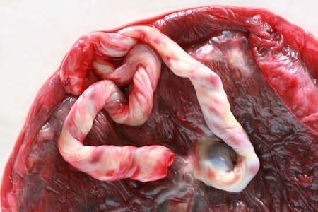 stem cell tissue