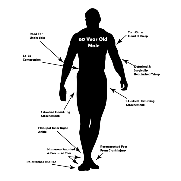 60-year-old-male-m