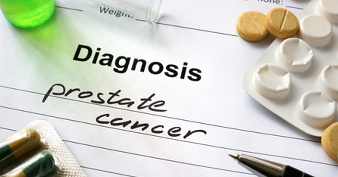 prostate cancer diagnosis