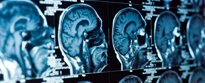human brain mri