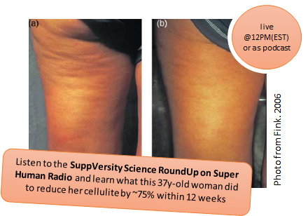 cellulite